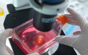 国内供卵的费用多少钱,做试管穿刺取精前有些事情不能做 前后注意相关事项是关键