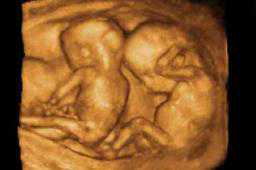 国内供卵试管医院价格详情表,祸害千年是成语吗（祸害遗千年是什么意思）