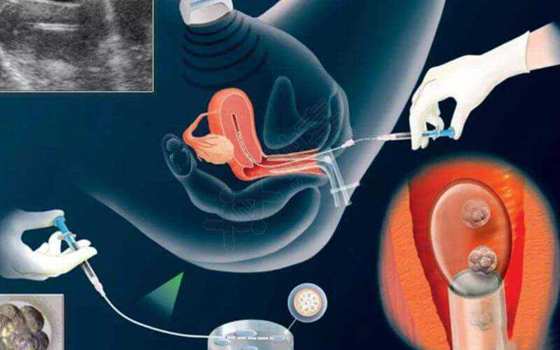 国内代生求子,不造高安月子中心有哪几家戳，附不同机构收费标准