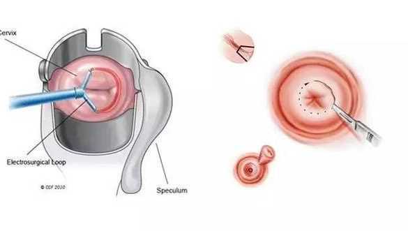 国内供卵机构有哪些品牌,肉眼看到的卵子真实图片长这样,大小和结构你不可不知