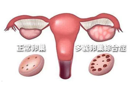 国内代怀生殖助孕机构,50万才能做混血试管婴儿？这份美国供卵费用明细送给你