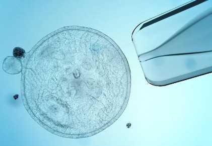国内供卵网,试管七细胞好吗,年龄是影响移植成功率主因