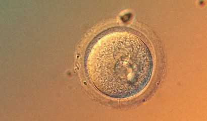 中国哪家医院能提供供卵试管,网传十个新生儿拍片有九个肺部感染是真的吗?