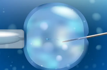 国内做供卵试管机构排名,绝经后供卵试管移植失败别着急，及时检查找出病因很关键