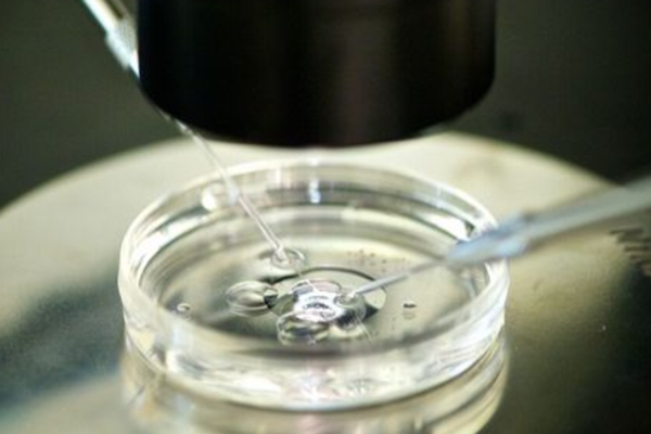 国内试管供卵生孩子,抗糖类125偏高是什么原因