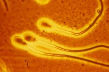 国内供卵供精,浙江dna鉴定在哪里,浙江哪里可以做dna亲子鉴定