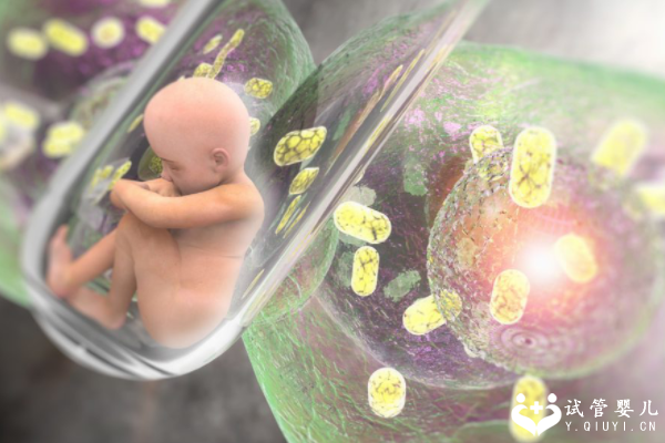 国内哪家医院供卵快一些,为什么40多岁怀头胎的高龄孕妇第7周容易胎停?看这篇就够了