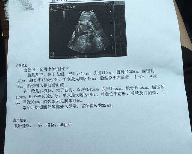 国内可以供卵的医院排名,圣元优聪奶粉价格是多少（圣元优聪2段奶粉价格）